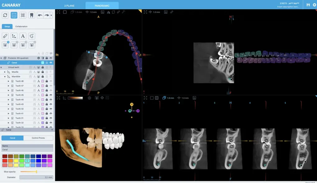 Building advanced dental imaging software on the web